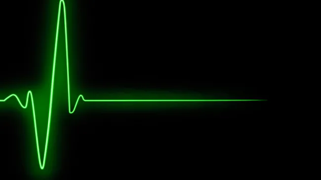 l shaped v shaped recovery recession